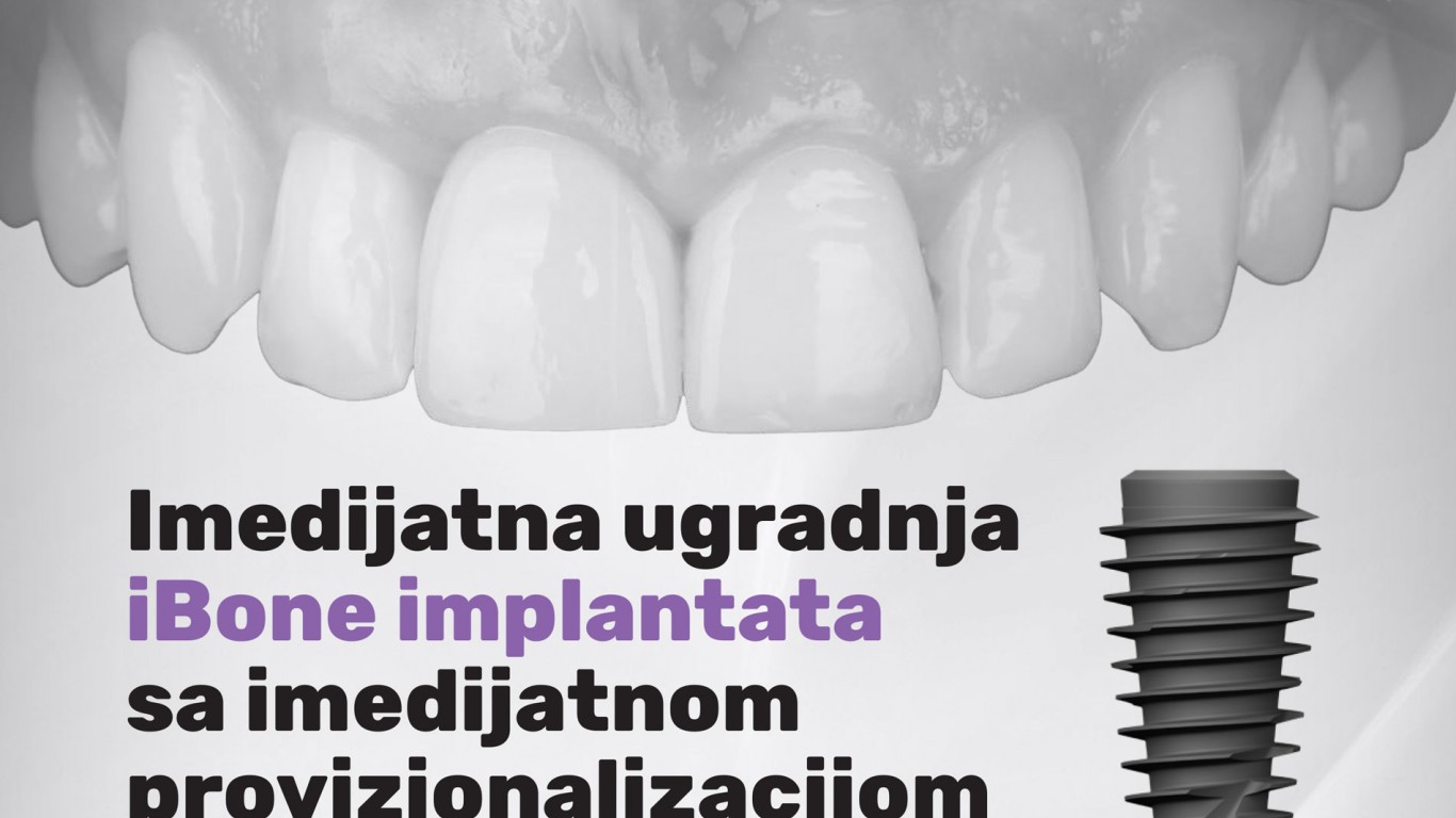 Imedijatna ugradnja iBone implantata sa imedijatnom provizionalizacijom
