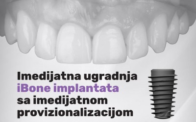 Imedijatna ugradnja iBone implantata sa imedijatnom provizionalizacijom