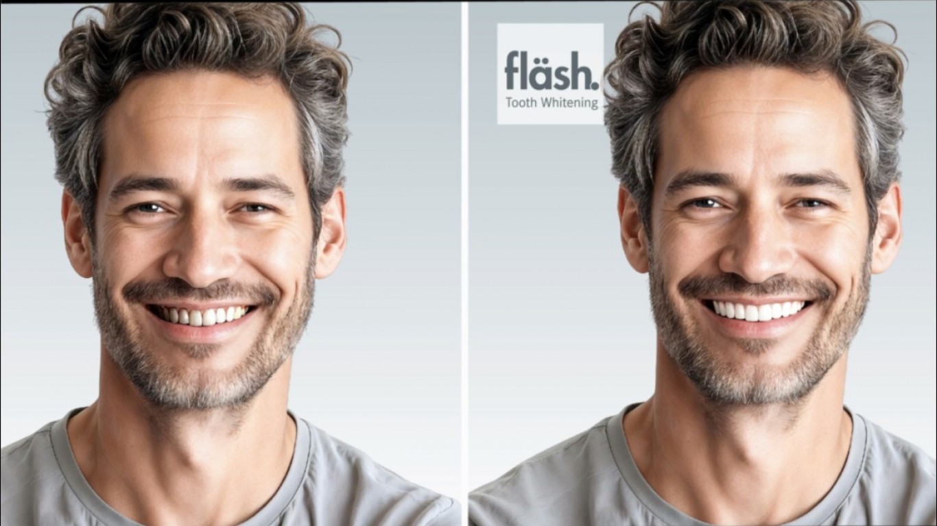 Izbeljivanje zuba - Stomatolozi veruju. Pacijenti vole.