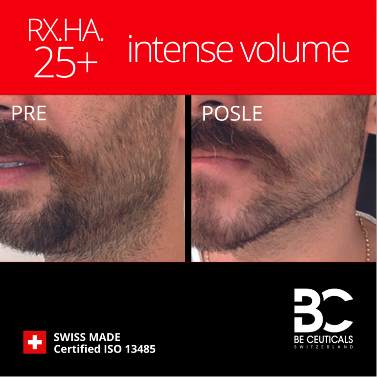 Hijaluronski Filer Rx.ha.25+Mg - Intense Volume