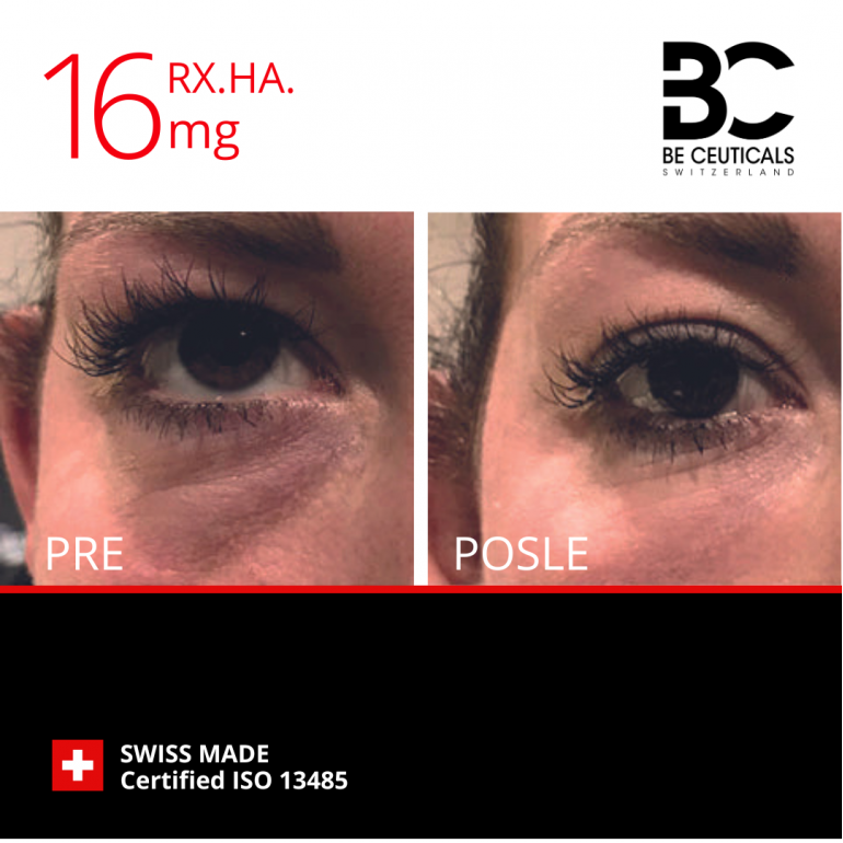 Hijaluronski Filer Rx.ha.16Mg - First Lines
