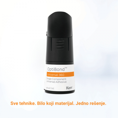 Kerr OptiBond Universal 360 - jedan bond za sve