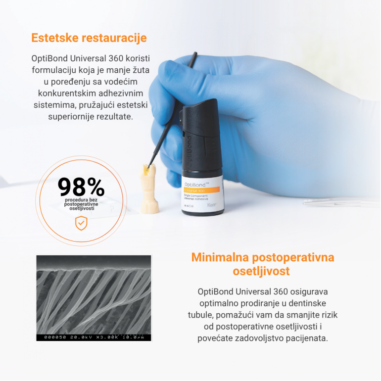 Kerr Optibond Universal 360 - Jedan Bond Za Sve